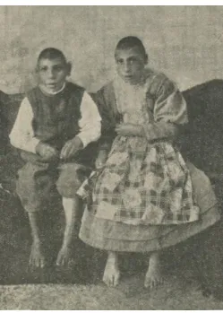 Figura 3. Os irmãos António e Adelaide  preparados  para  serem  exibidos  em  espectáculo  de  feira
