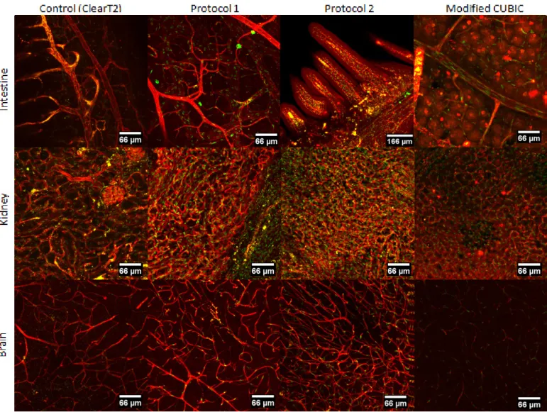 Figure 7 - Test of other clearing protocols for intestine, kidney and brain. All protocols started with a modified version of CB- CB-perfusion, except for control that started with a simple perfusion