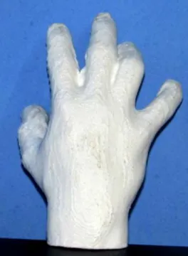 Figura 5 – Fotografia da última análise da mão  Fonte: Acervo de pesquisa do autor 