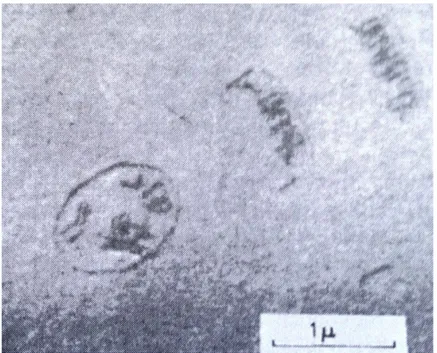 Figura 16 – Micrografia do mecanismo de Frank Read de multiplicação de discordâncias em uma liga de alumínio com 4% Cu.