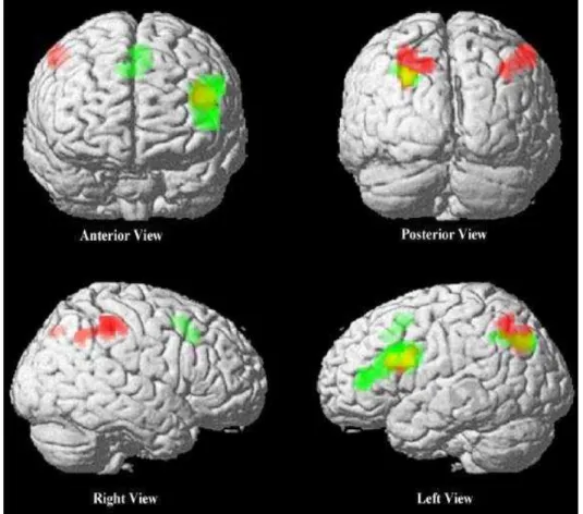 Figura 12- The neural substrate of arithmetic operations and  procedure complexity. Brain Res