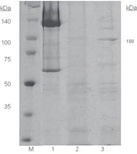 Figura  1  –  Análise  do  perfil  protéico  das  estirpes  estudadas.  M  –  marcador  de  massa  molecular (Broad range – Promega, 1 – Btk, 2 – S2186 (4B), 3 – 2183 (6B).