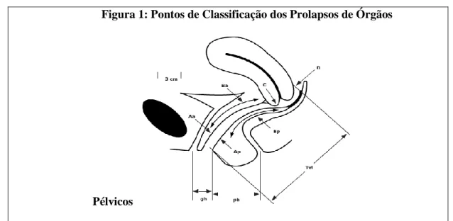 Figura 1: Pontos de Classificação dos Prolapsos de Órgãos 