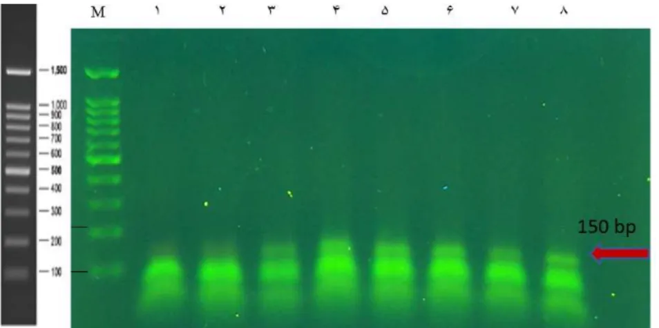 Table 12. The G1691A mutation frequency in the coagulation Factor 5 in sample groups ControlPatient