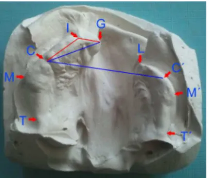 Figure 1 Identification of individual landmarks used for linear and angular (GIC-red, GC-CC′-blue) measurements.