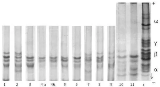 Fig. 2 – Types of avenin electrophoretic banding patterns in the studied oat cultivars (1-11), аСОКЭ РХТКНТЧ (Ϸ),  , ί, ΰ, КЧН  ω – prolamin fractions 