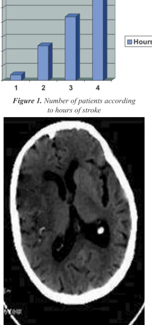 Figure 2. Noncontrast computed tomography with CVI of right temporal lobeFigure 1. Number of patients according