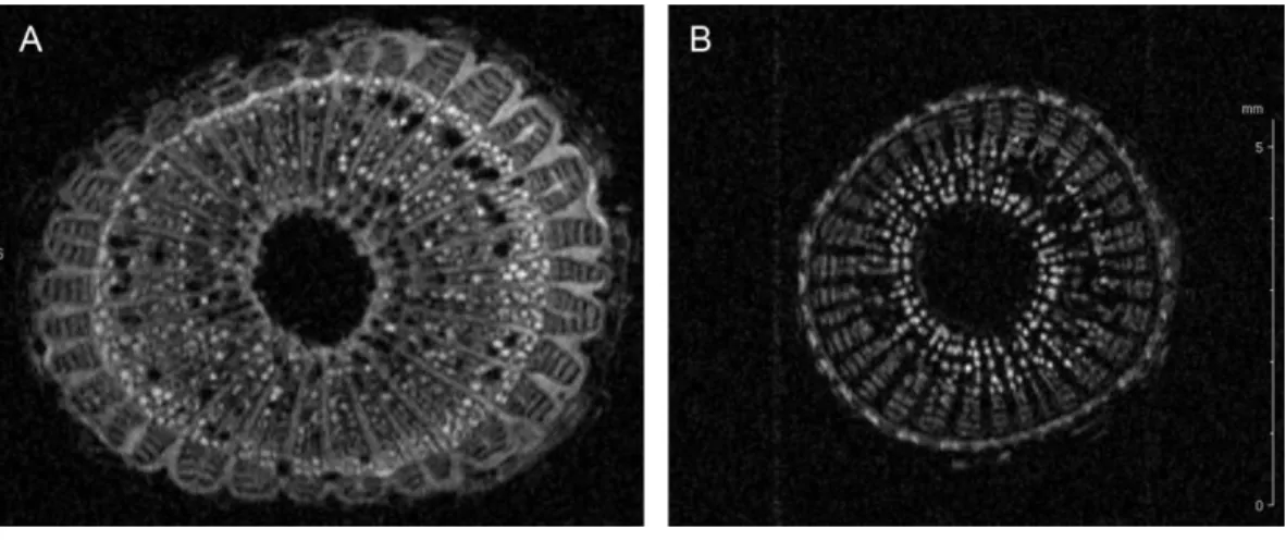 Figure 2 Cell wall thickening of infected grapevines. Magnetic resonance imaging (1H-MRI) of stems of Xylella fastidiosa (A) infected and (B) non-infected grapevines