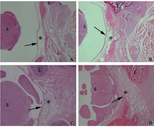 Figure 5 The effect of HCPT on epidural fibrosis in rats. The representative photomicrographs of the epidural fibrotic tissues in each group