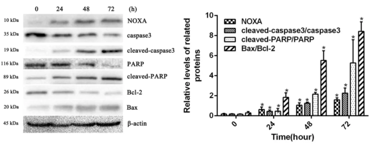 Figure 2 HCPT up-regulated NOXA expression. Western blot analysis showed that HCPT increased the expression of NOXA, which was accompanied by increasing expression of cleaved caspase3, cleaved-PARP and Bax, and the decreasing expression of caspase3, PARP a