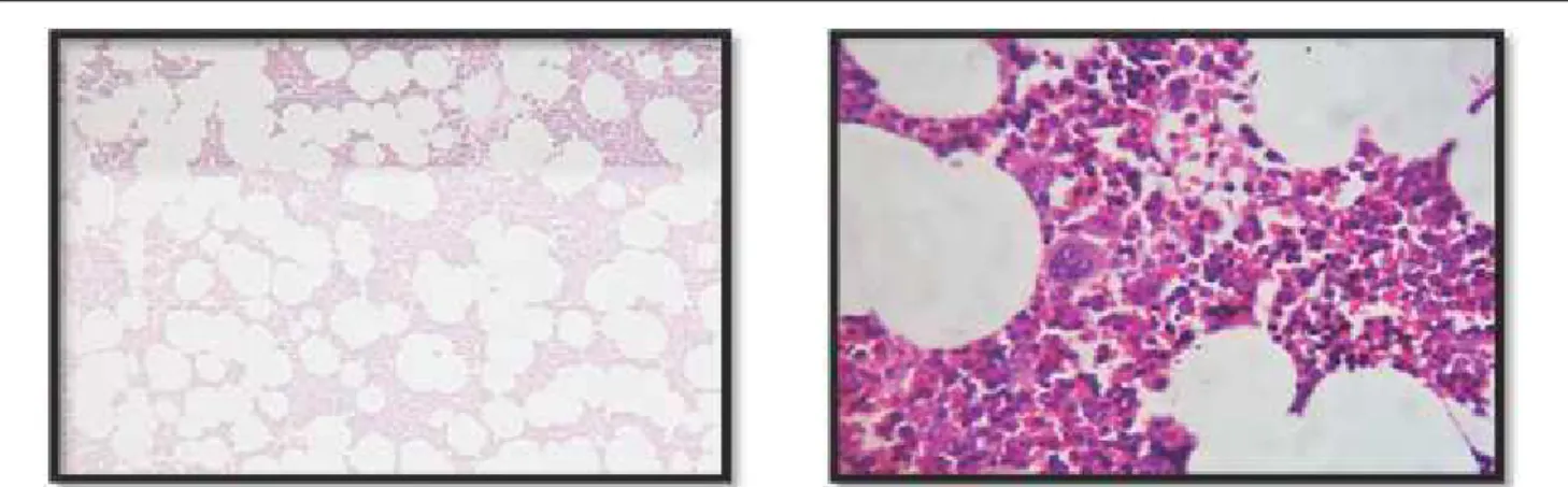 Fig. 2: Mature Adipose Tissue with Hematopoietic Elements a) H and E 100X b) H and E 400X