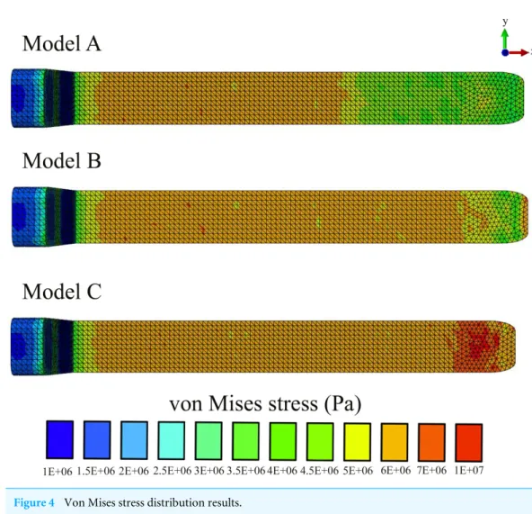 Figure 4 Von Mises stress distribution results.