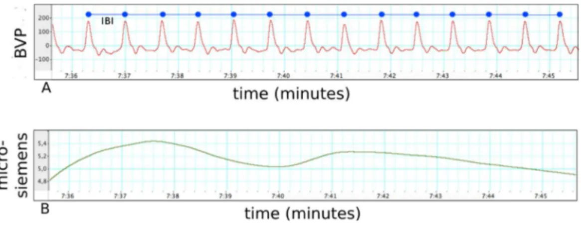 Figure 4 Physiological measures. (A) The graph of a participant’s blood volume pulse during 10 s