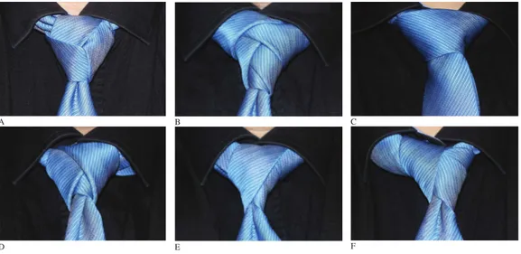 Figure 1 Some specific tie-knot examples. Top row from left: the Trinity (L-110.4), the Eldredge (L-373.2) and the Balthus (C-63.0, the largest knot listed by Fink and Mao)