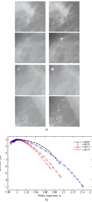 Fig.  6.    FROC  curves  showing  detection  performance  using  the  three  multifractal  methods on  different  datasets