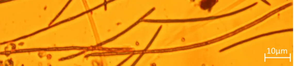 Figura 1.2.1. 1 - Microfotografia de Cylindrospermospsis raciborskii em microscopia de  contraste de fase (Zeiss Axio Observer LD A-PLAN 40x/0,50 Ph2) de uma amostra da Ribeira 