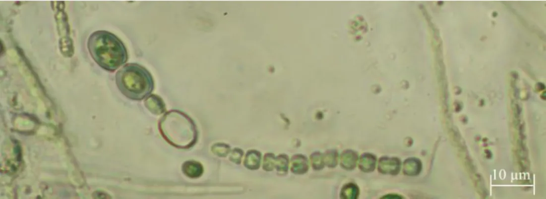 Figura 1.2.2. 1 - Microfotografia de Chrysosporum ovalisporum em microscopia de  contraste de fase (Zeiss Axio Observer LD A-PLAN 40x/0,50 Ph2) de uma cultura 