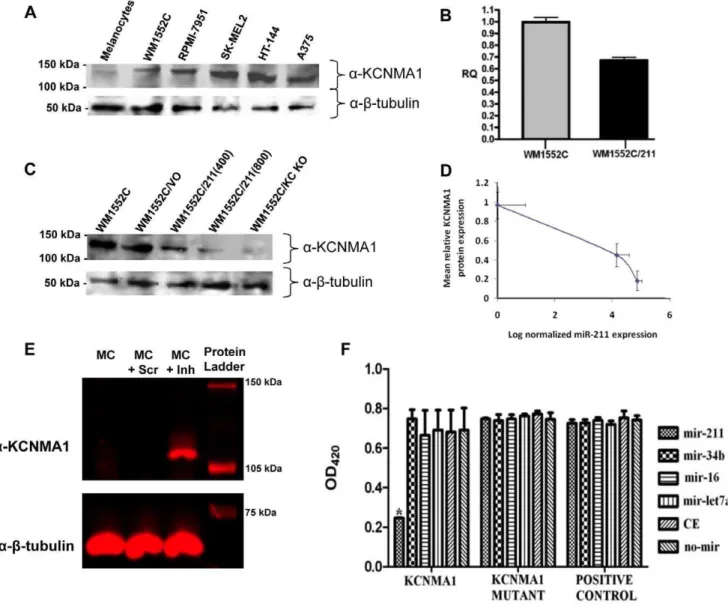 Figure 6. KCNMA1 mRNA is a direct target of miR-211. A) Western blot analysis of KCNMA1 protein expression in melanocytes and melanoma cell lines