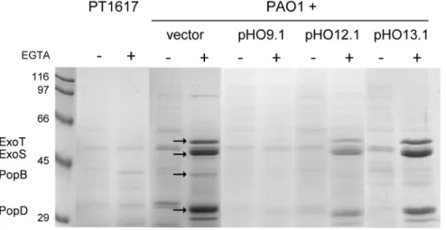 Figure 10. QS-dependent virulence factor production by vqsM mutants. Pyocyanin, rhamnolipid and elastase production were determined as described in Material and Methods.The defined vqsM deletion mutant of PAO1 (PT1842), and the vqsM mutant (PAO1-UW) of the