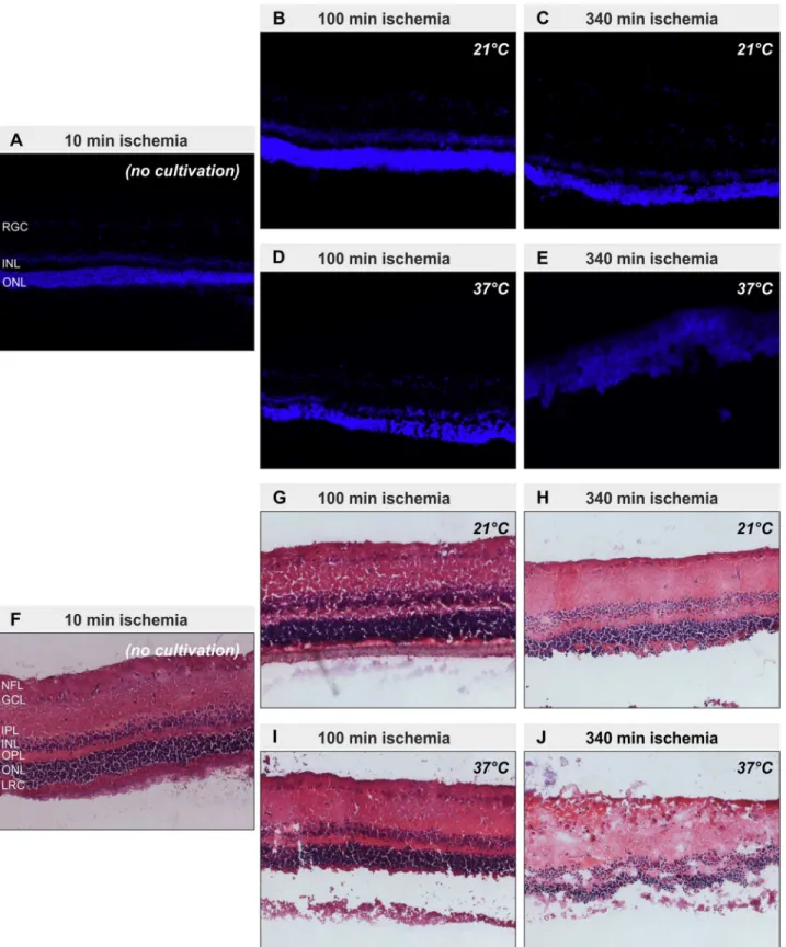 Fig 3. Retinal structure is preserved at 21°C storage. Representative pictures of cryosections of the five different groups (10 min ischemia (no cultivation) (A, F); 100 min ischemia at 21°C (B, G); 340 min ischemia at 21°C (C, H); 100 min ischemia at 37°C