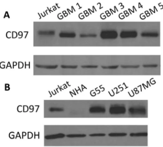 Figure 1. CD97 is expressed in primary GBM cultures and GBM cell lines. Five low passage primary GBM cultures and three GBM cell lines were analyzed