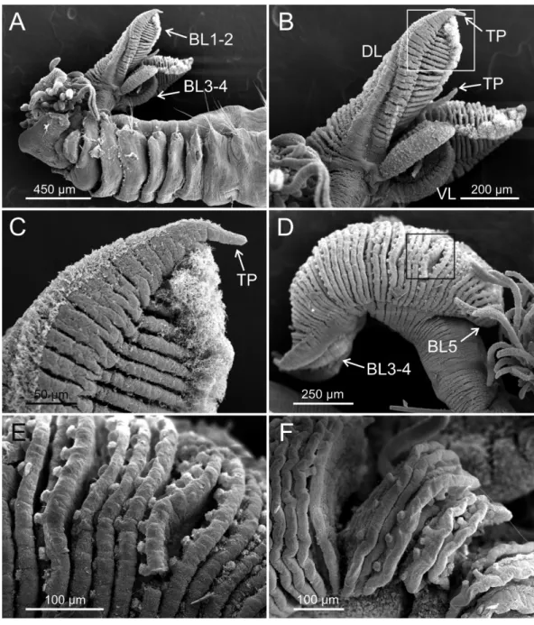 Figure 3 SEM micrographs of paratypes of Terebellides hutchingsae spec. nov. from Thailand.
