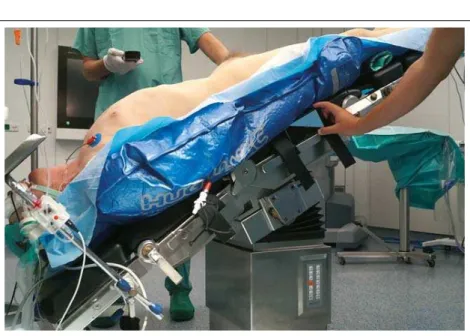 Abbildung 2: Probelagerung des Patienten vor dem sterilen Abdecken.
