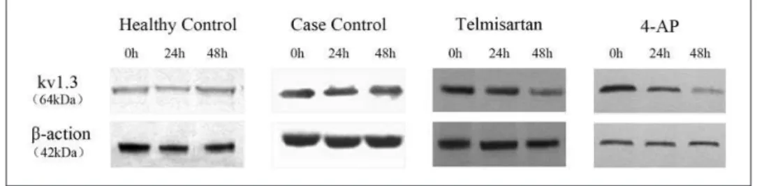 Figure 4.  Protein expression of the Kv1.3 potassium channel  relative to β-actin in samples extracted from activated  peripheral blood CD4 +  T lymphocytes from Xinjiang Kazakh  essential hypertension (EH) patients, determined by Western  blotting