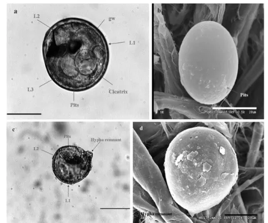 Figure 2. Morphology of spores of Acaulospora scrobiculata. a, c - structure of Acaulospora scrobiculata,  gw: germinal wall