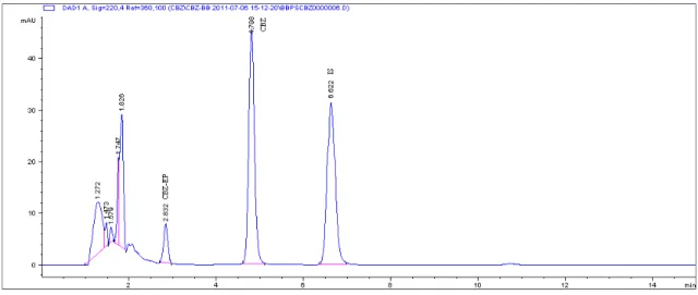 Fig. 2.  Chromatogram of plasma sample from a patient treated with 400 mg/day of CBZ, subjected to the developed SPE  procedure.