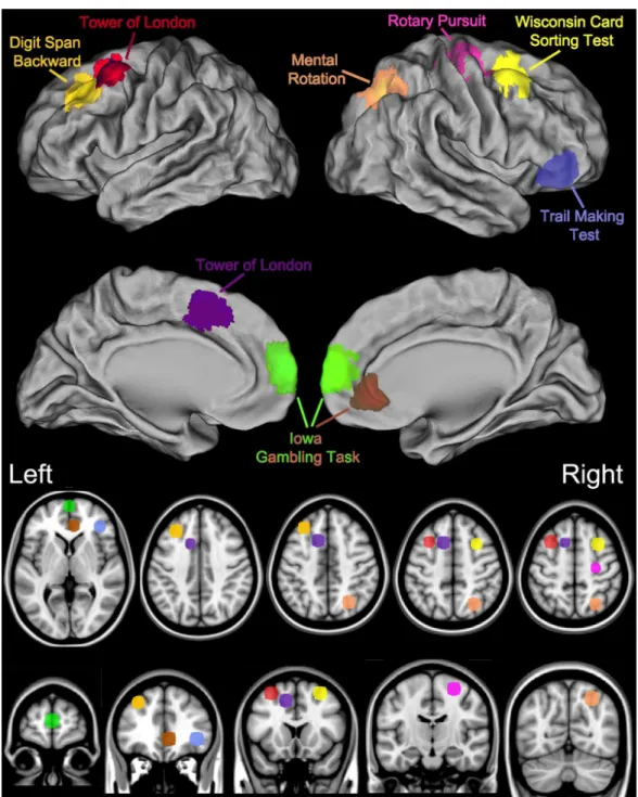 Figure 1 Key brain areas as identified by neuroimaging and lesion studies and the corresponding Psychology Experiment Building Language Tests.