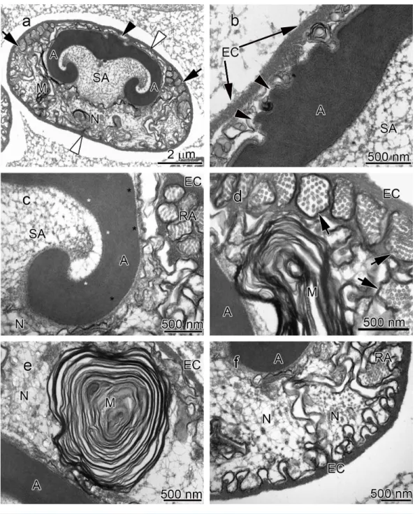 Figure 1 Transmission electron micrographs of Cambarus robustus spermatozoon. (A) longitudinal sagittal view of the entire spermatozoon, black arrows show sections of radial arms
