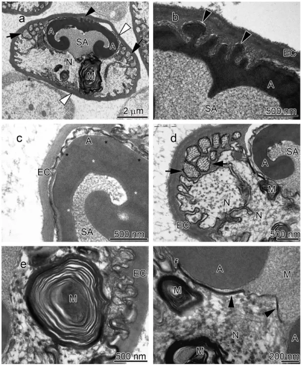 Figure 2 Transmission electron micrographs of Orconectes propinquus spermatozoon. (A) longitudi- longitudi-nal sagittal view of the entire spermatozoon, black arrows show sections of radial arms