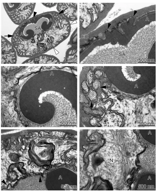 Figure 3 Transmission electron micrographs of Orconectes rusticus spermatozoon. (A) longitudinal sagittal view of the entire spermatozoon, black arrows show sections of radial arms