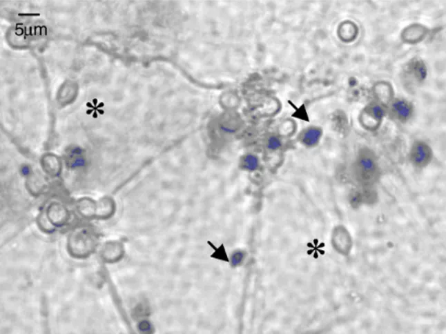 Figure 3. Illustration of the result of the Trypan blue exclusion assay on cell culture