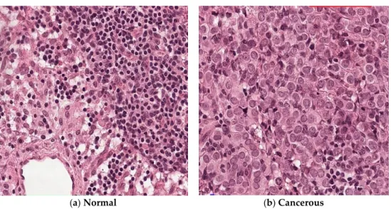 Figure 3. Samples of the PatchCamelyon dataset. (a) A normal sample. (b) A cancerous sample