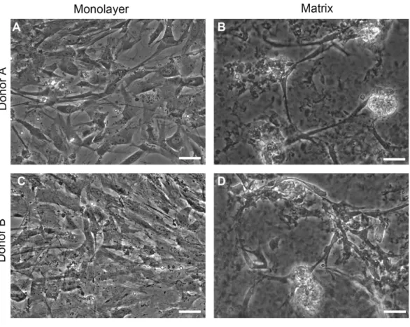 Figure 2 Phase contrast images. Normal human astrocytes cultured in monolayer (A, C) and matrix (B, D) environments for five days and were imaged live, prior to RNA extraction for transcriptome analysis.