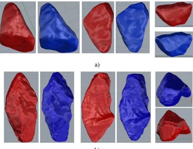 Fig. 11. Digital models of particle IV: (a) particle scanned in 3 phases; (b) particle scanned in a single phase, with the aid of the support.
