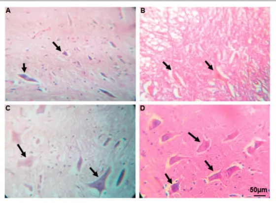 Figure 8. Transverse section of spinal cord showing the lower motor neurons in ventral horn of spinal cord at the level of T12-L1 of all groups which were evaluated in this study on Day 56