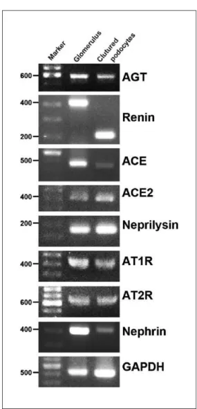 Figure 1.  mRNA expression of RAS components.