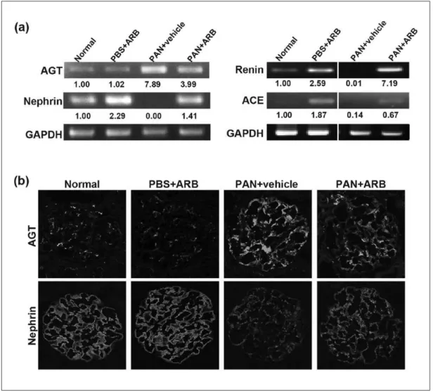 Figure 4.  ARB treatment suppressed the increased AGT expression in PAN nephropathy.