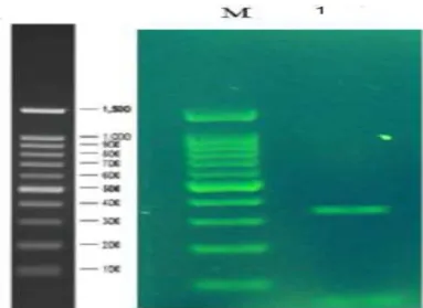 Figure 1: PCR reaction results for G20210A mutation diagnosis. 100bp marker molecular sink M – sink 1 containing  340bp section  