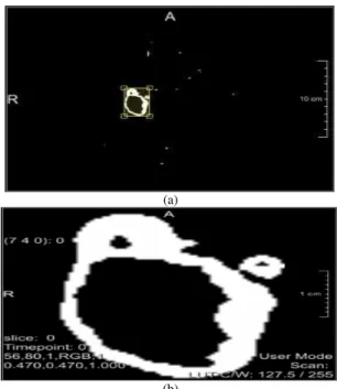 Fig. 3. De-Noising process for the ROI. (a) Original Image (b) Median  Filtering 