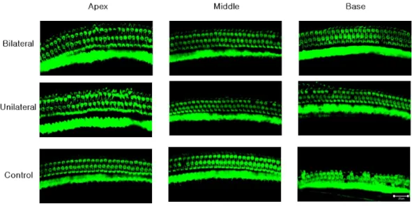 Figure 3 Representative confocal images of hair cells at three different locations (apex, middle, and base) in each experimental group