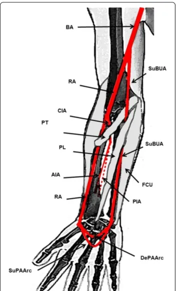 Figure 3 Schematic drawing of the origin and distribution of the superficial brachioulnar artery and its relation with the medial epicondyle muscles