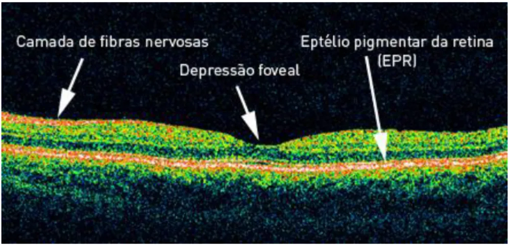 Figura 2 – Camadas da retina observadas pelo OCT (2)  