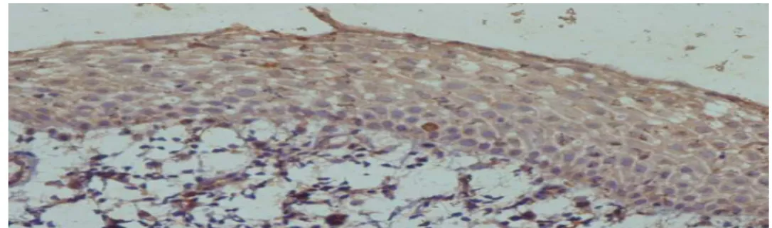 Figure 1: immunohistochemical staining of normal mucosa (magnification X40) 