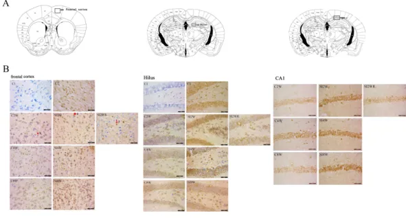 Figure 4 Increased ADAR1 (p110) immunoreactivity in frontal cortex and hippocampus of social iso- iso-lated mice and its recovery by re-socialization