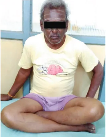 Fig. 3c: Forward bending (Prayer/ Namaz) position.