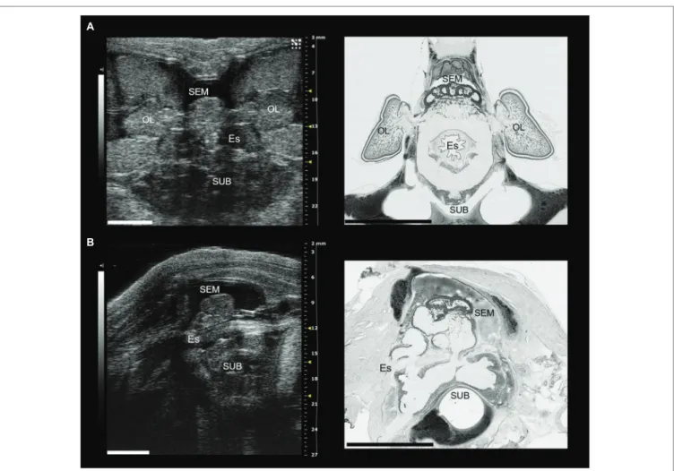 FIGURE 1 |  The brain of Octopus vulgaris as it appears using sonographic scanning (for additional details see Grimaldi et al., 2007) and histological sections after  Nissl staining (in black and white)